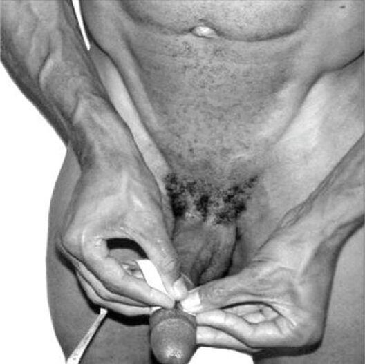 Mesurer le pénis avant l'agrandissement.